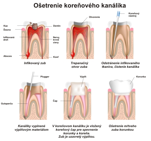 osetrenie_korenoveho_kanalika.jpg